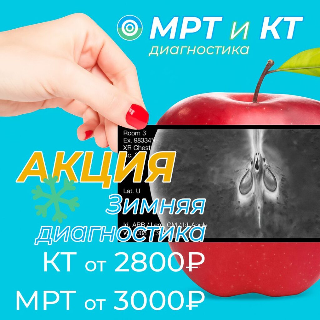 Акция Зимняя диагностика - КТ от 2800₽, МРТ от 3000₽